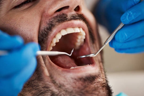 Best Emergency Root Canal Treatment in Eudora, KS
